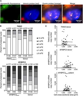 Transcriptional bursts and heterogeneity among cardiomyocytes in hypertrophic cardiomyopathy